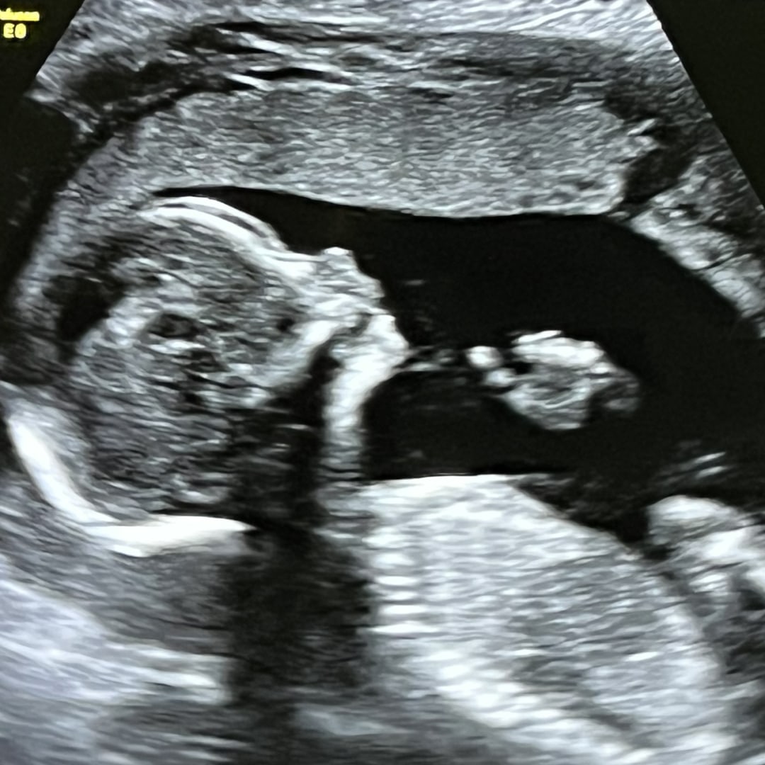 Photo shared by Ashley for their Babylist baby registry.