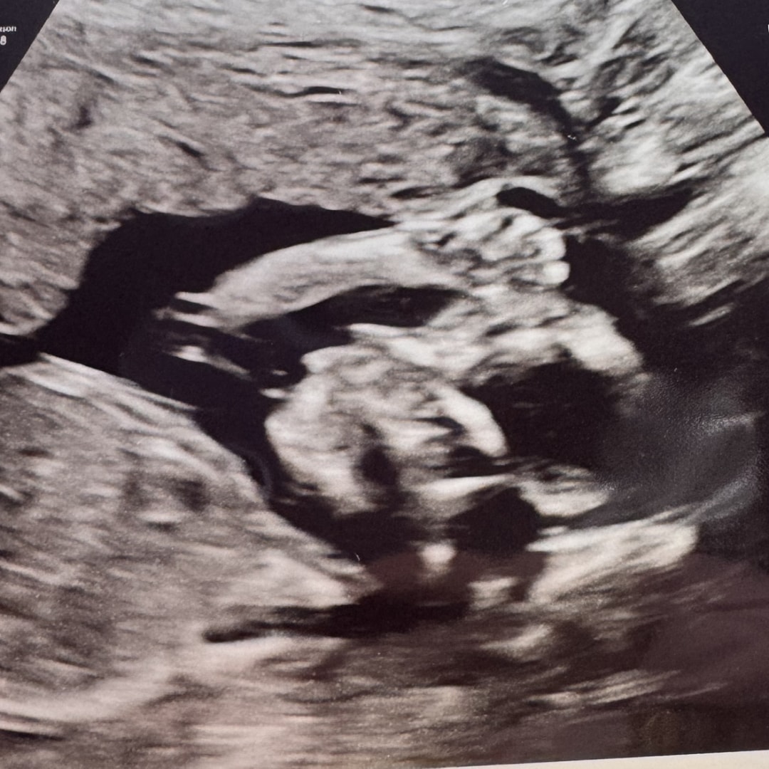 Photo shared by Wayne for their Babylist baby registry.