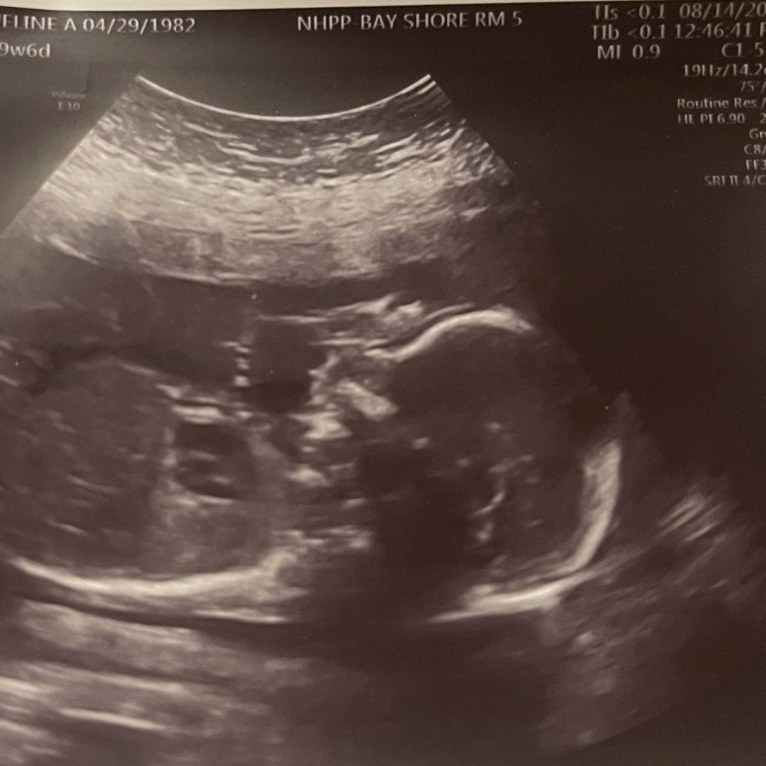 Photo shared by Jackie for their Babylist baby registry.