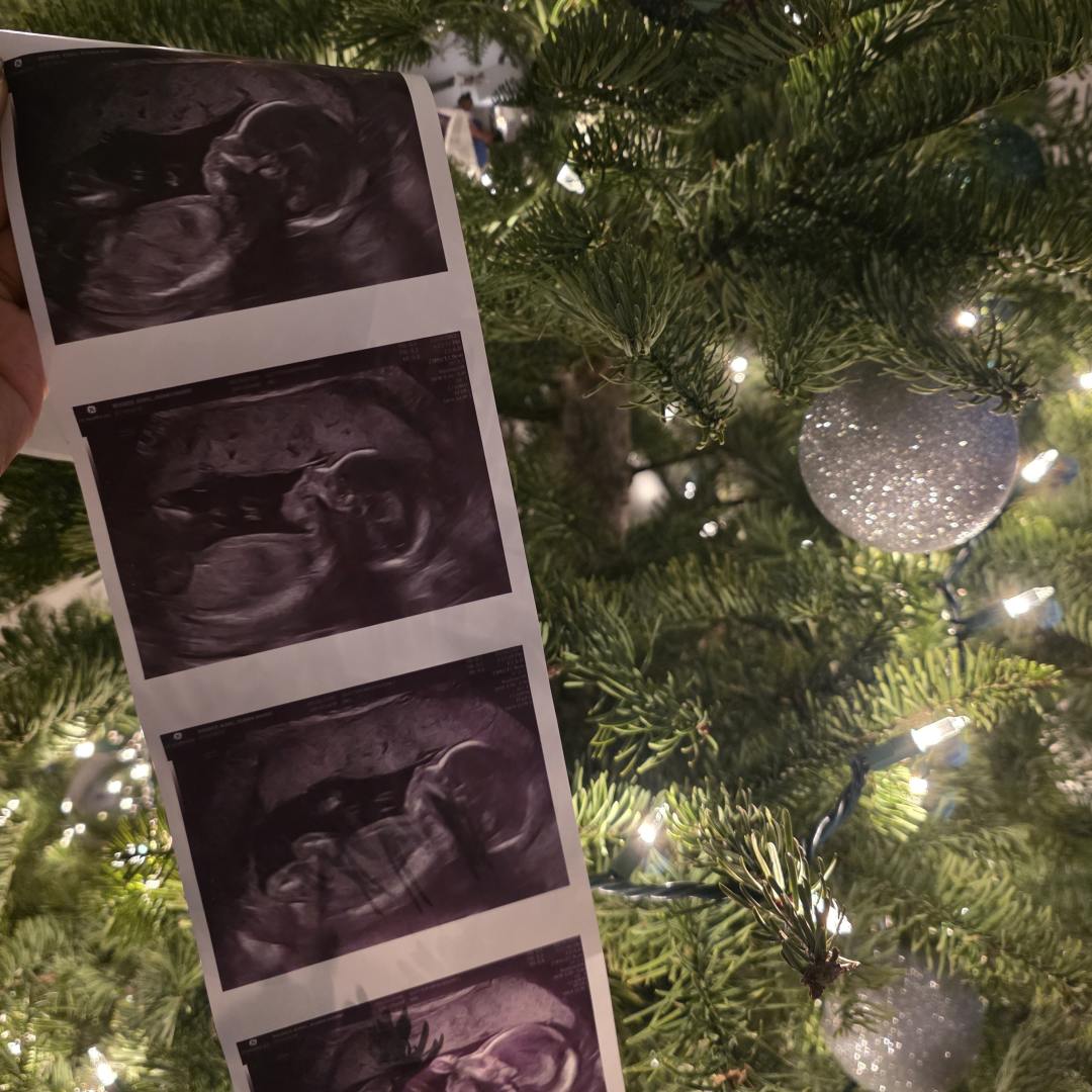 Photo shared by Kiara for their Babylist baby registry.