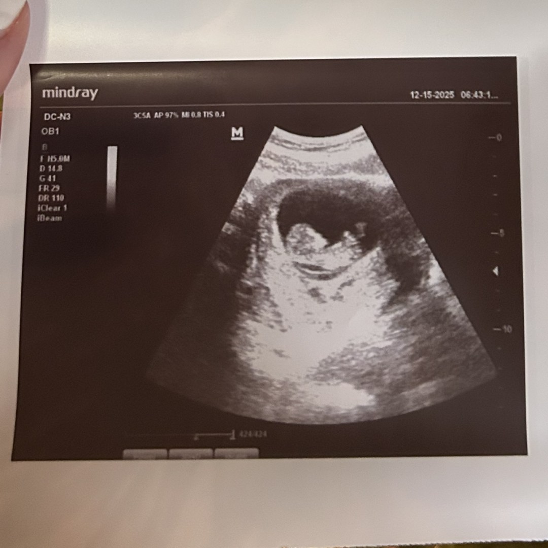 Photo shared by Madison for their Babylist baby registry.