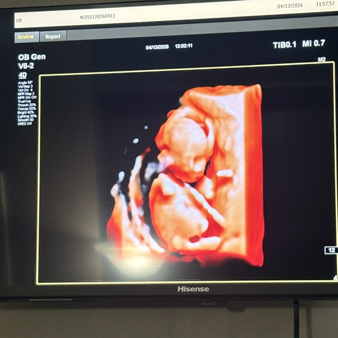 Photo shared by Jazmyn for their Babylist baby registry.