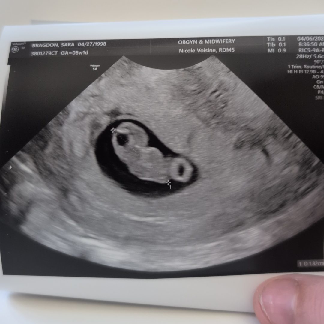 Photo shared by Sara for their Babylist baby registry.