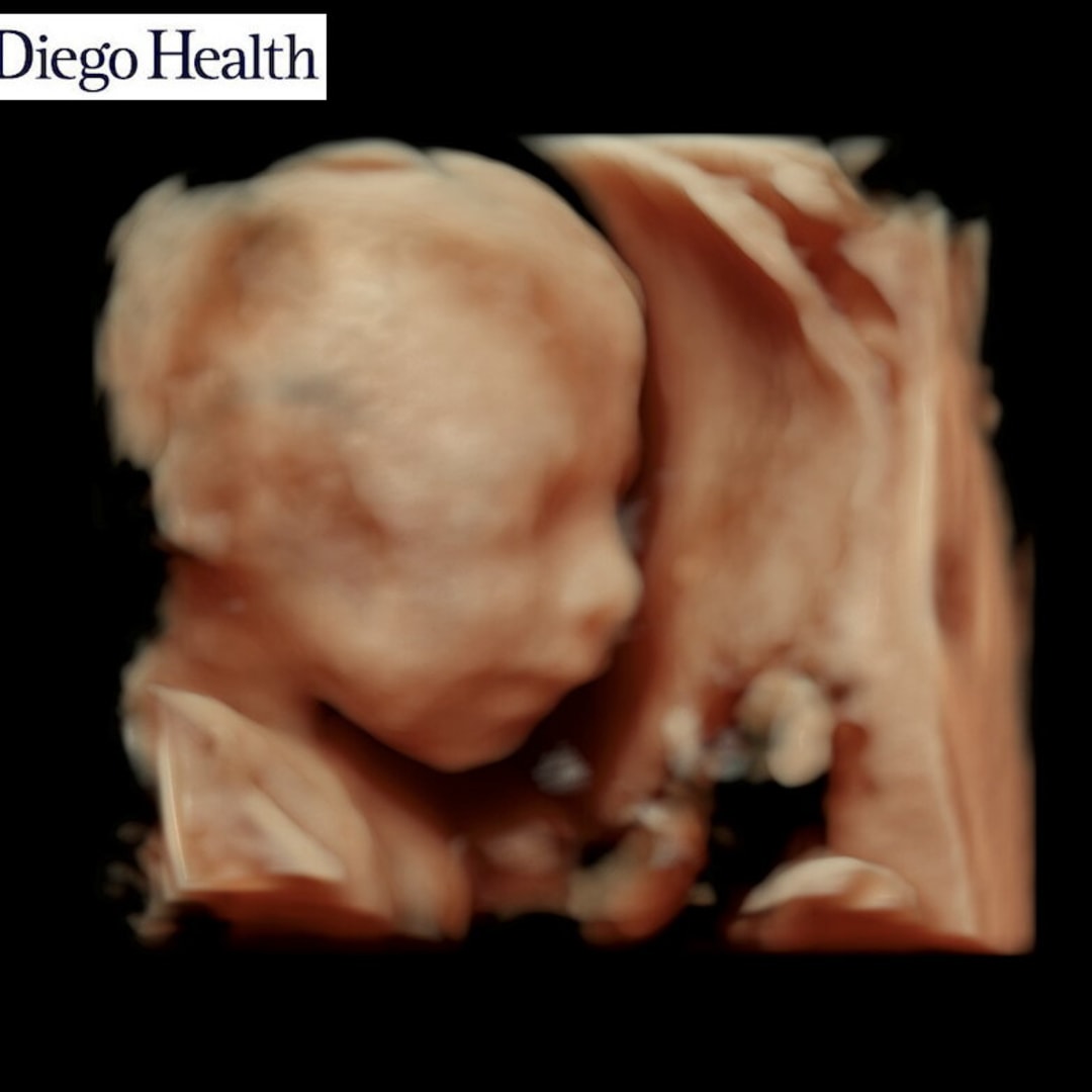 Photo shared by Celina for their Babylist baby registry.