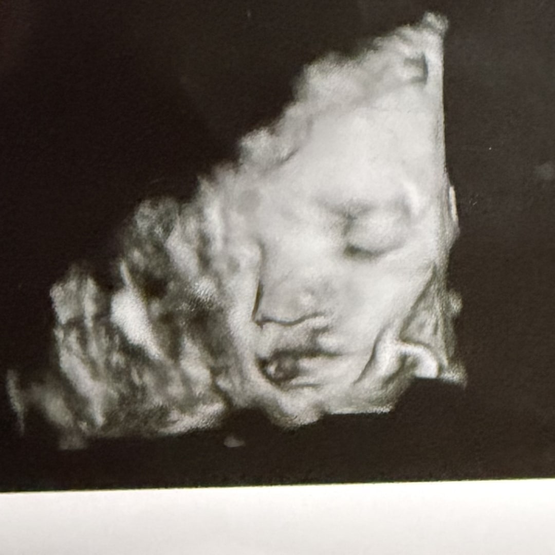 Photo shared by Haley for their Babylist baby registry.