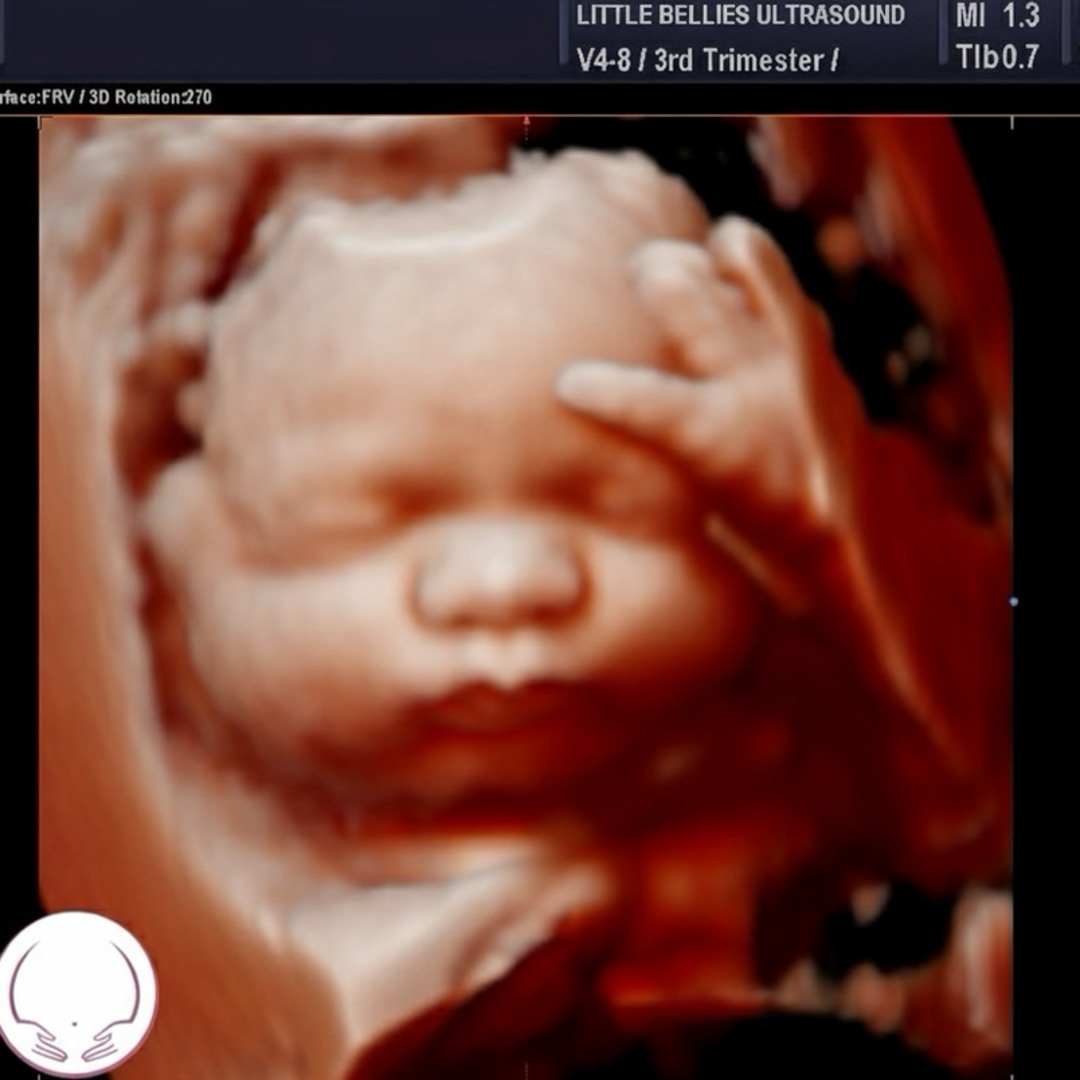 Photo shared by Chelsea for their Babylist baby registry.