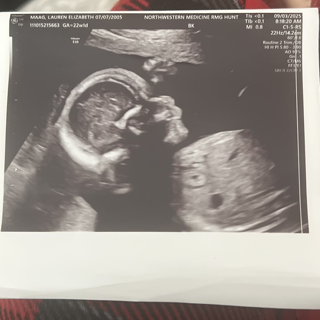 Photo shared by Lauren for their Babylist baby registry.