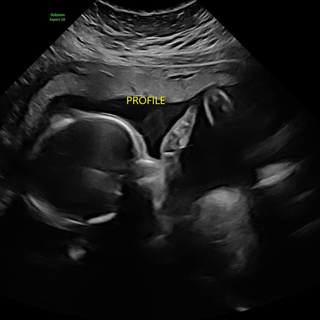 Photo shared by Kaitlin for their Babylist baby registry.