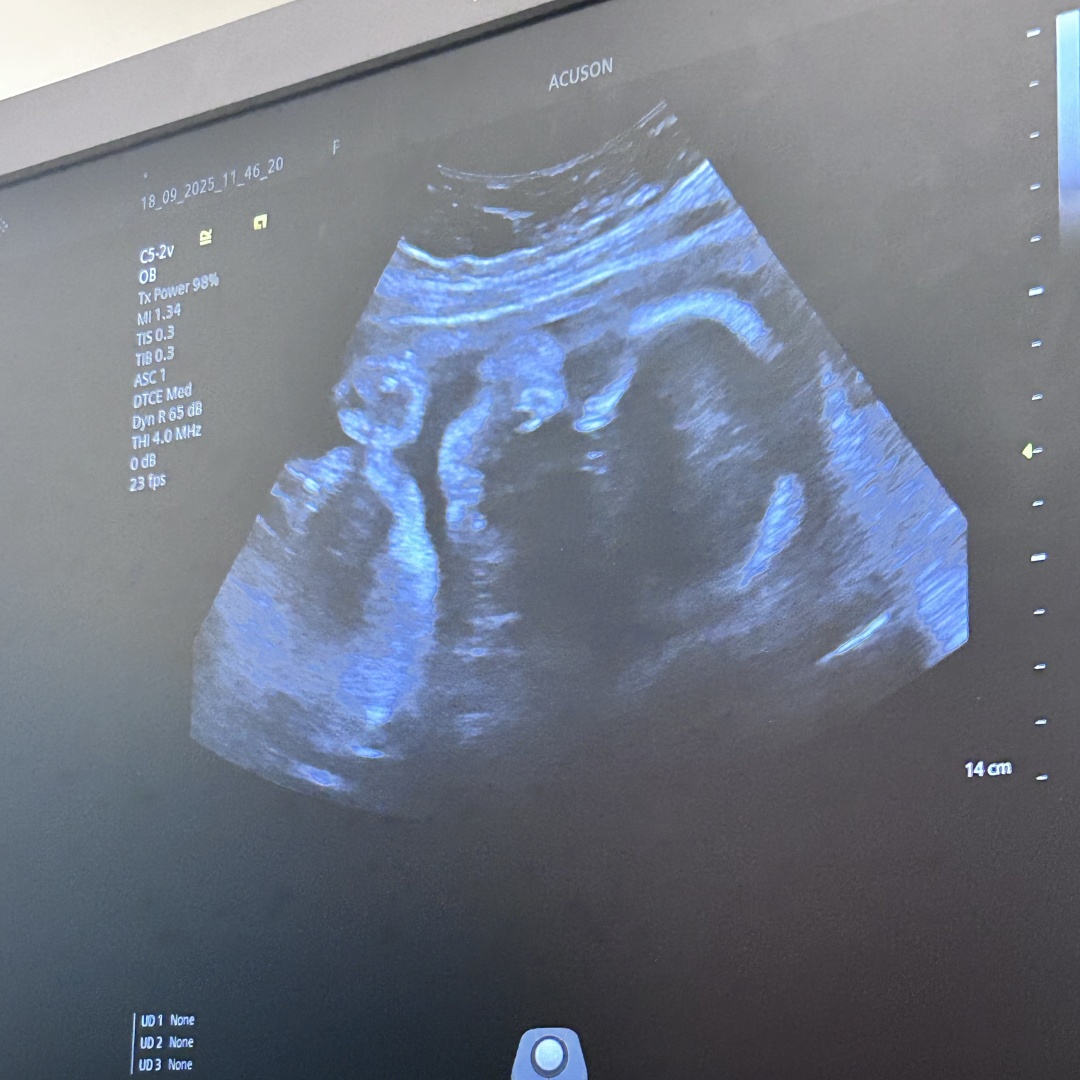 Photo shared by Kassidy for their Babylist baby registry.