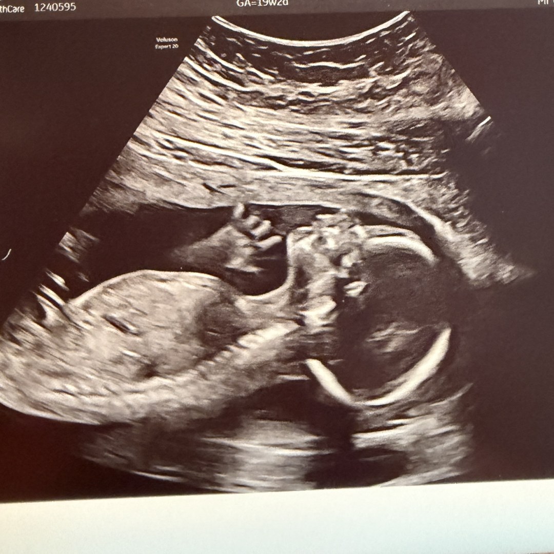 Photo shared by Cassey for their Babylist baby registry.