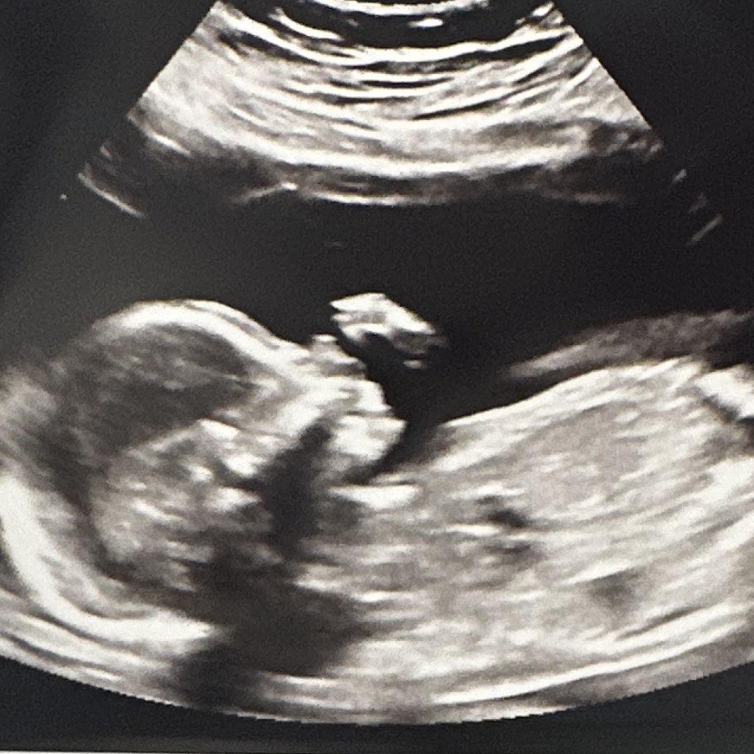 Photo shared by Justice for their Babylist baby registry.