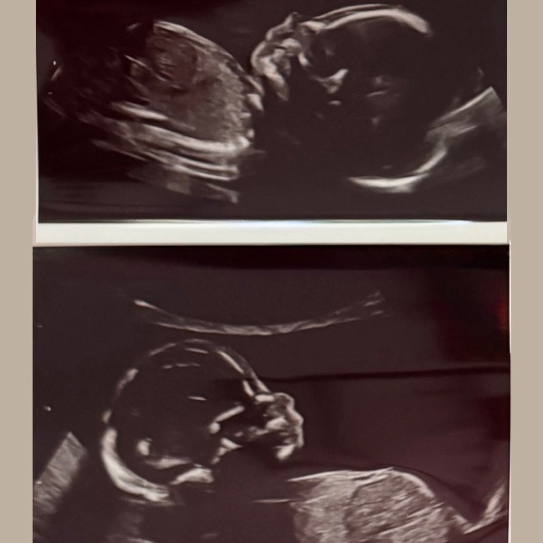Photo shared by Shannon for their Babylist baby registry.