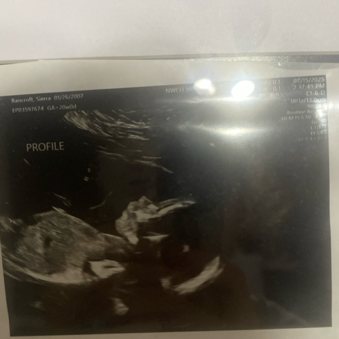Photo shared by Sierra for their Babylist baby registry.