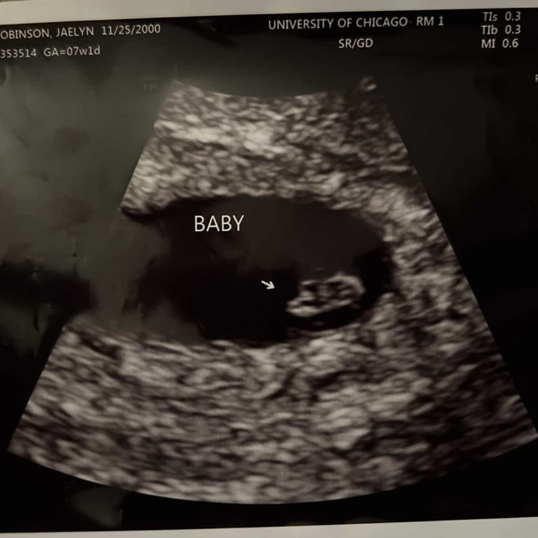 Photo shared by Jaelyn for their Babylist baby registry.