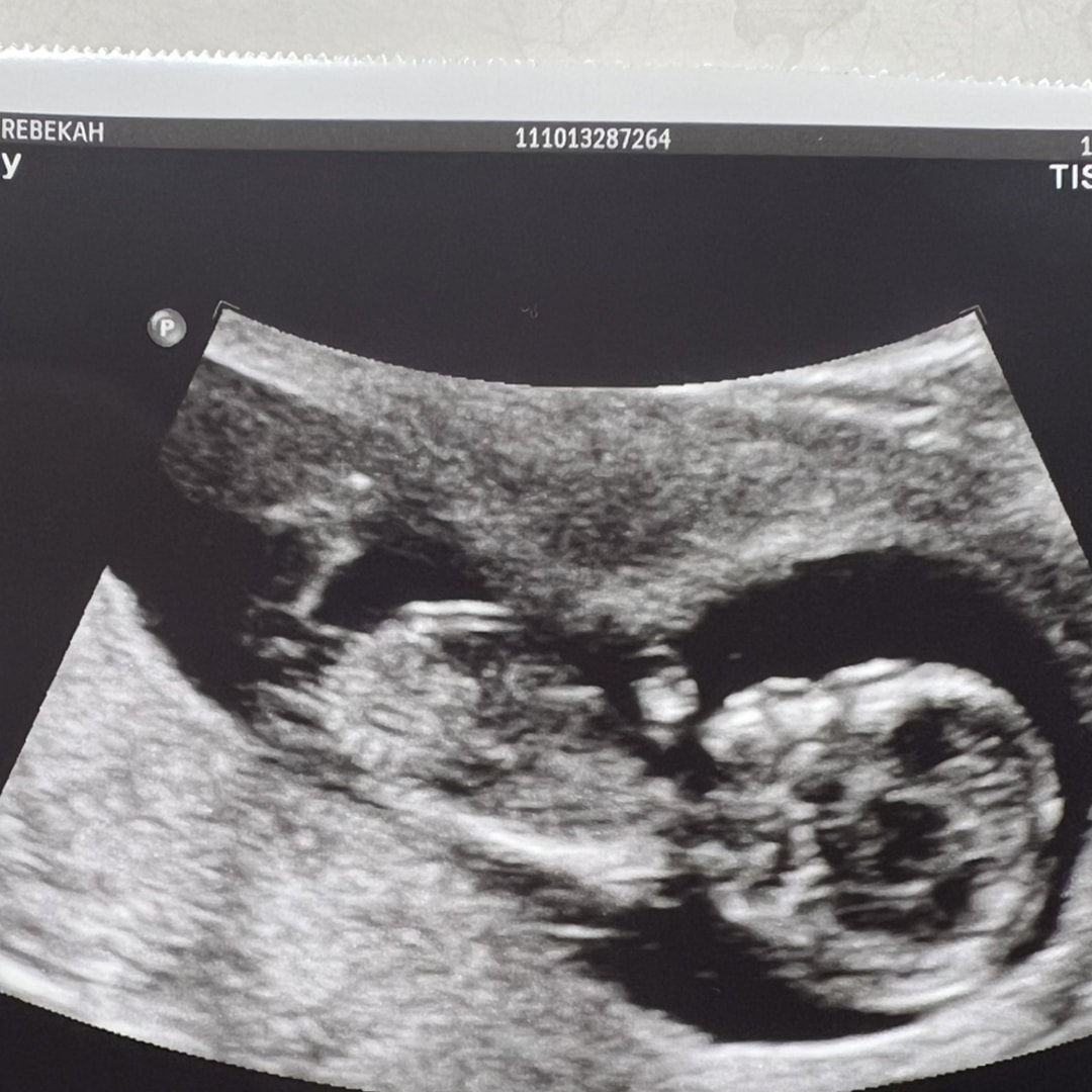 Photo shared by Bekah for their Babylist baby registry.