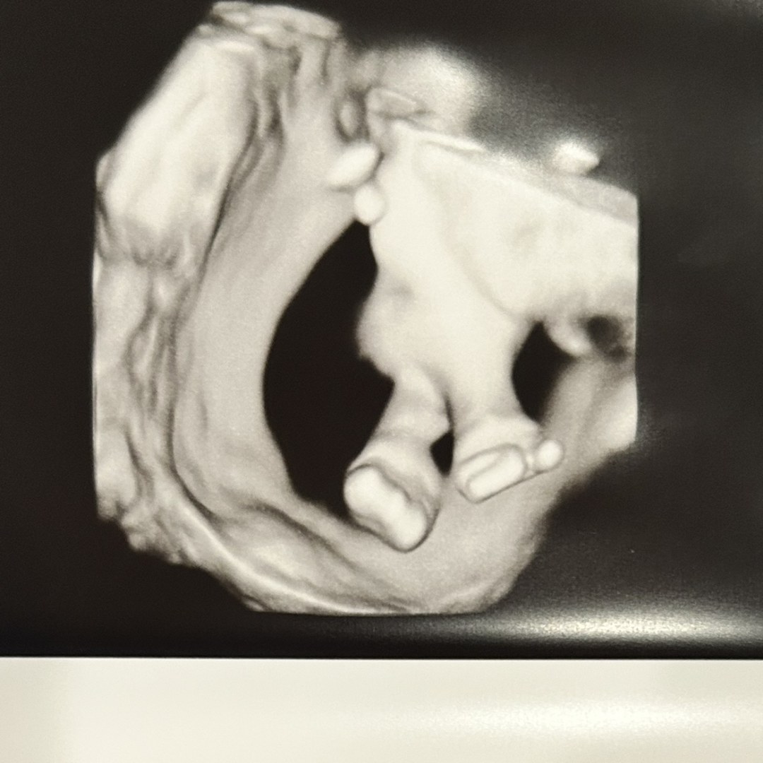 Photo shared by Taylor for their Babylist baby registry.
