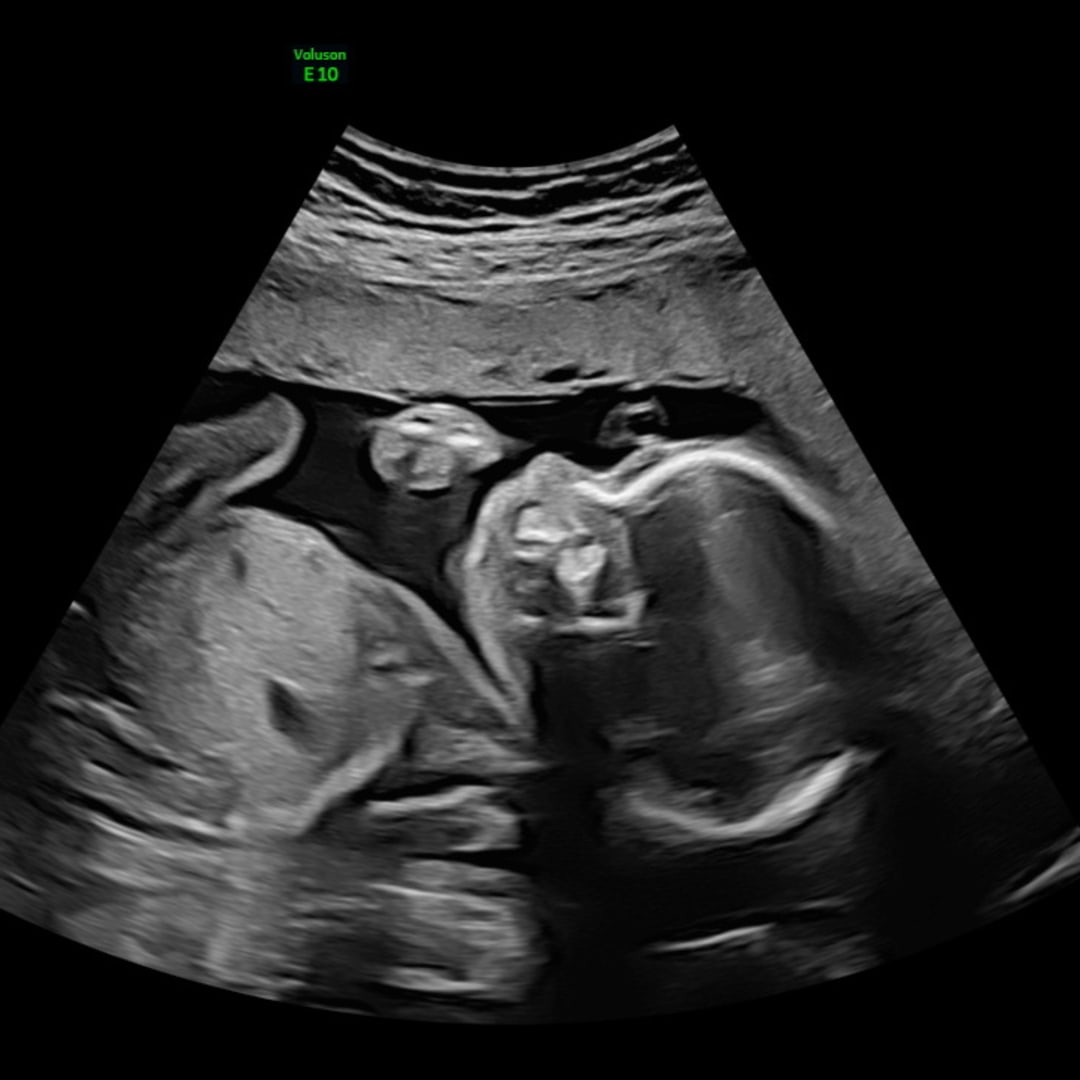 Photo shared by Grayce for their Babylist baby registry.