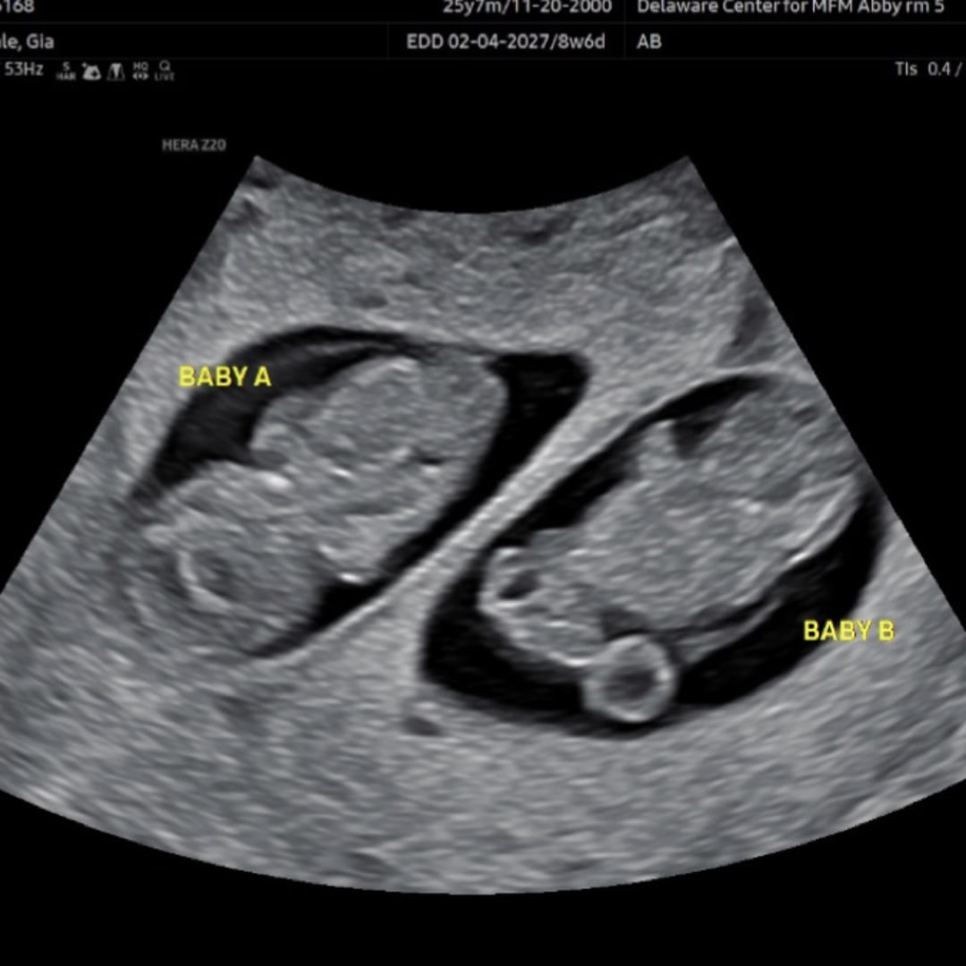 Photo shared by Gia for their Babylist baby registry.