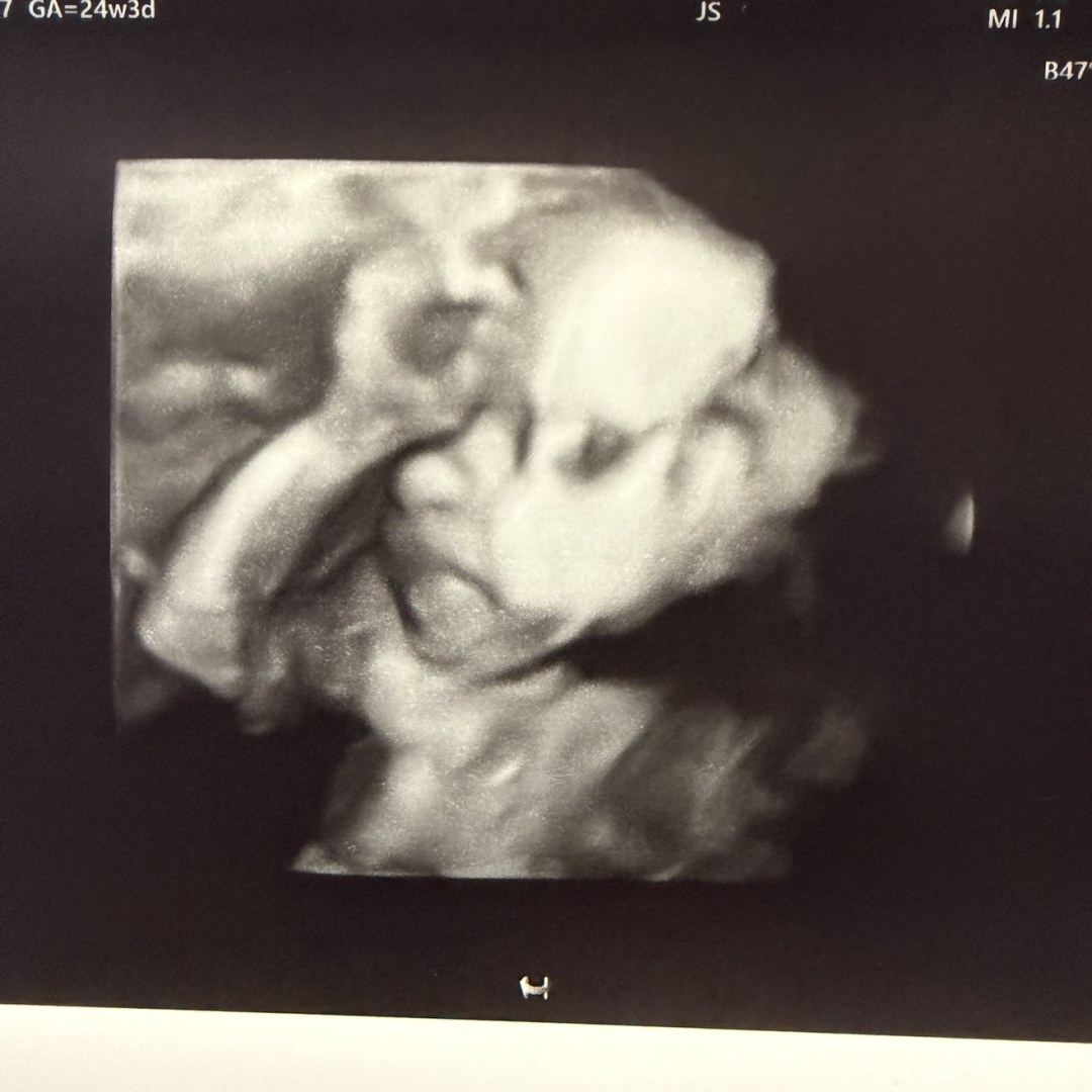 Photo shared by Nichole for their Babylist baby registry.