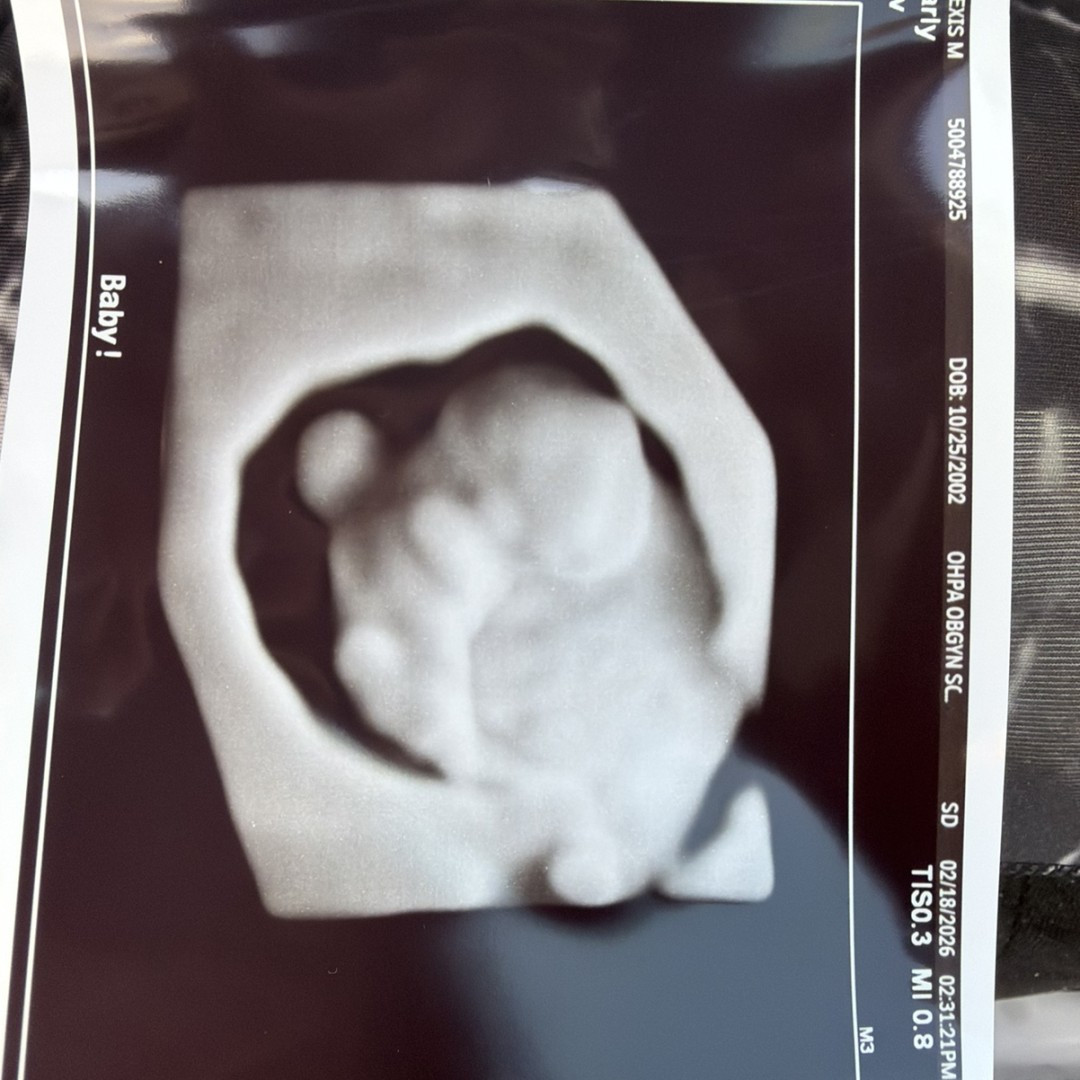 Photo shared by Alexis for their Babylist baby registry.