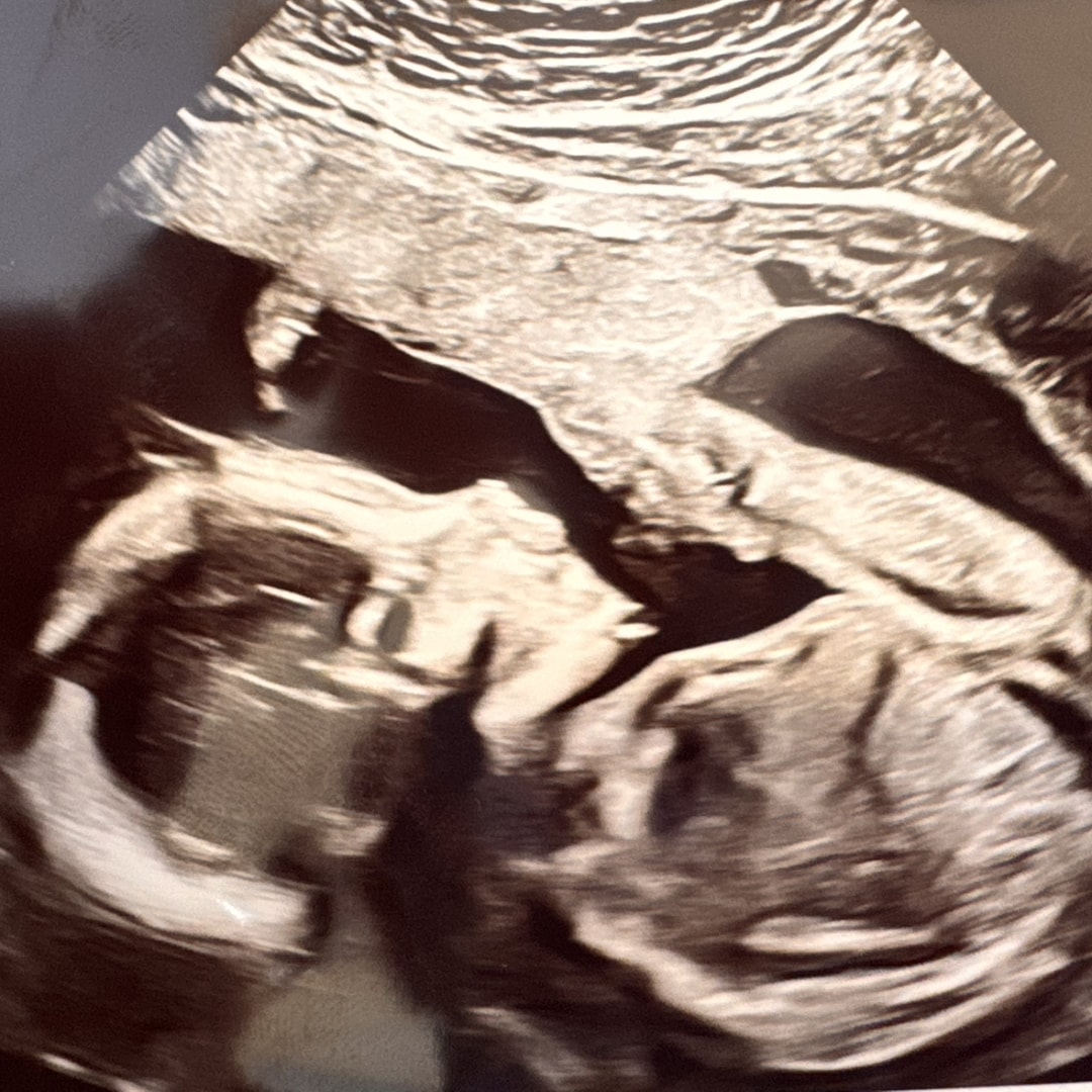 Photo shared by Alma for their Babylist baby registry.