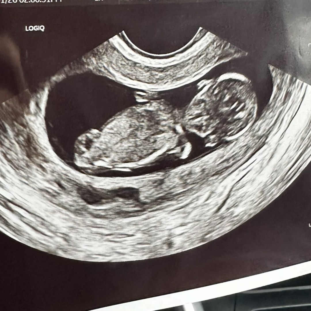 Photo shared by Sarah for their Babylist baby registry.