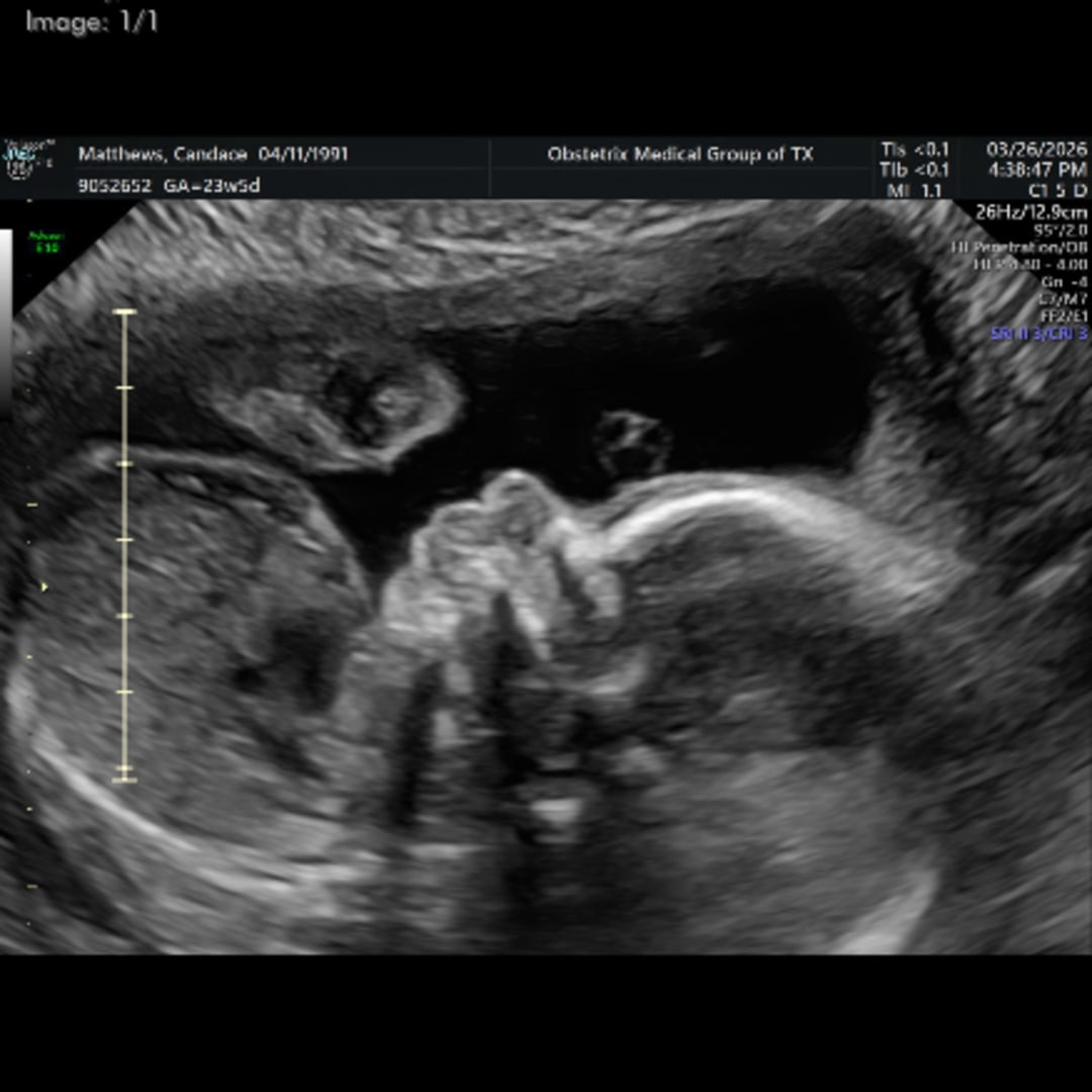 Photo shared by CANDACE for their Babylist baby registry.