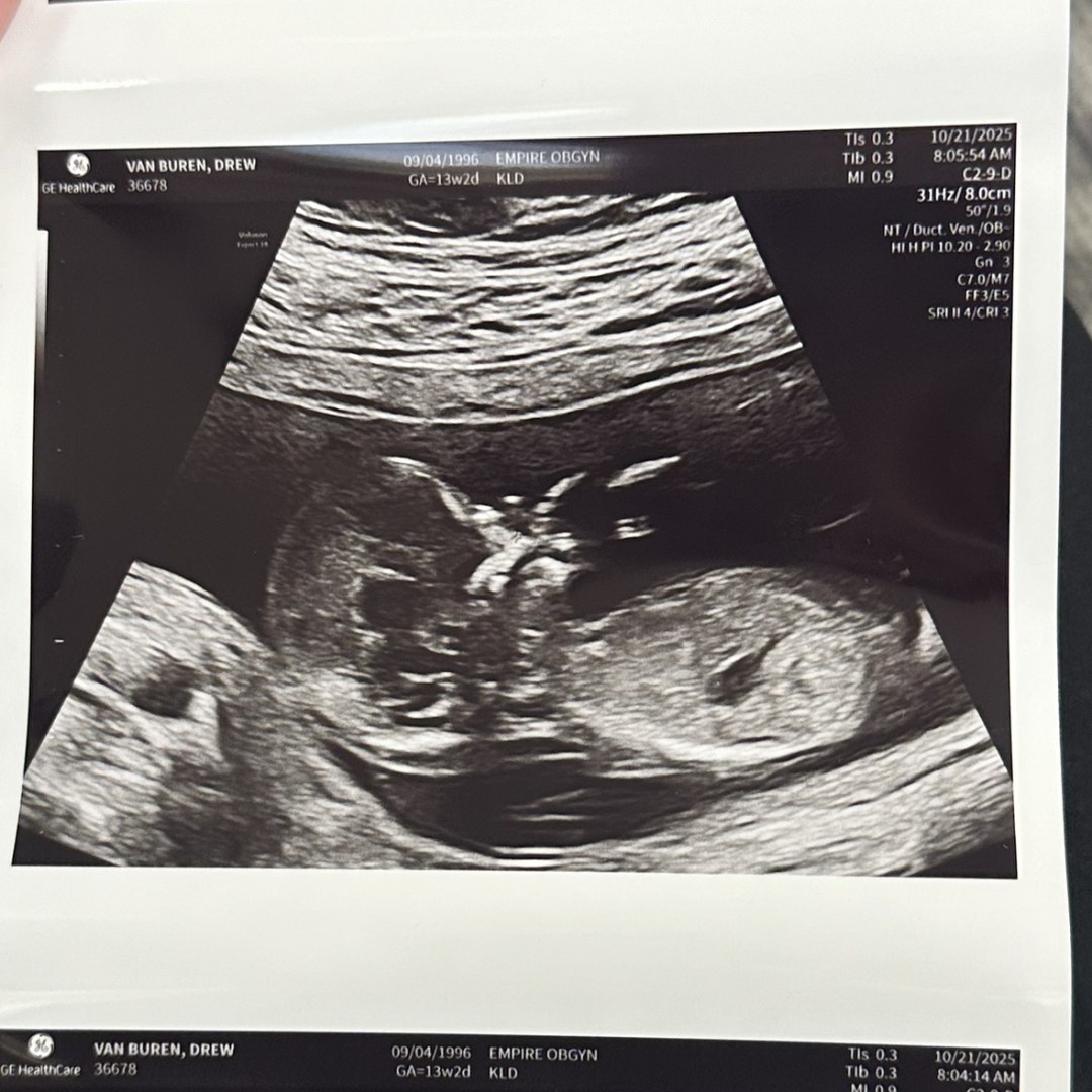 Photo shared by Drew for their Babylist baby registry.