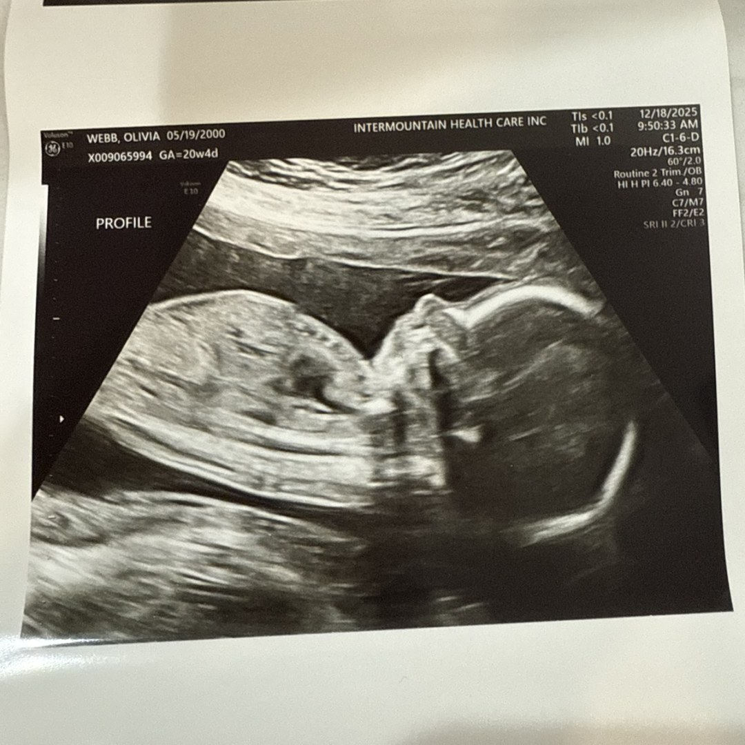 Photo shared by Olivia for their Babylist baby registry.