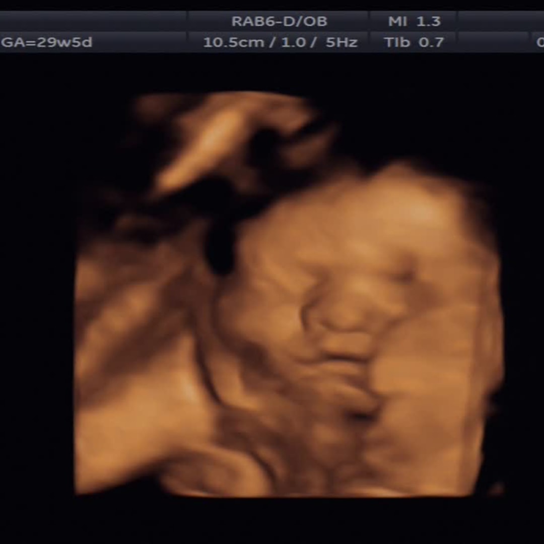 Photo shared by Gracsen for their Babylist baby registry.