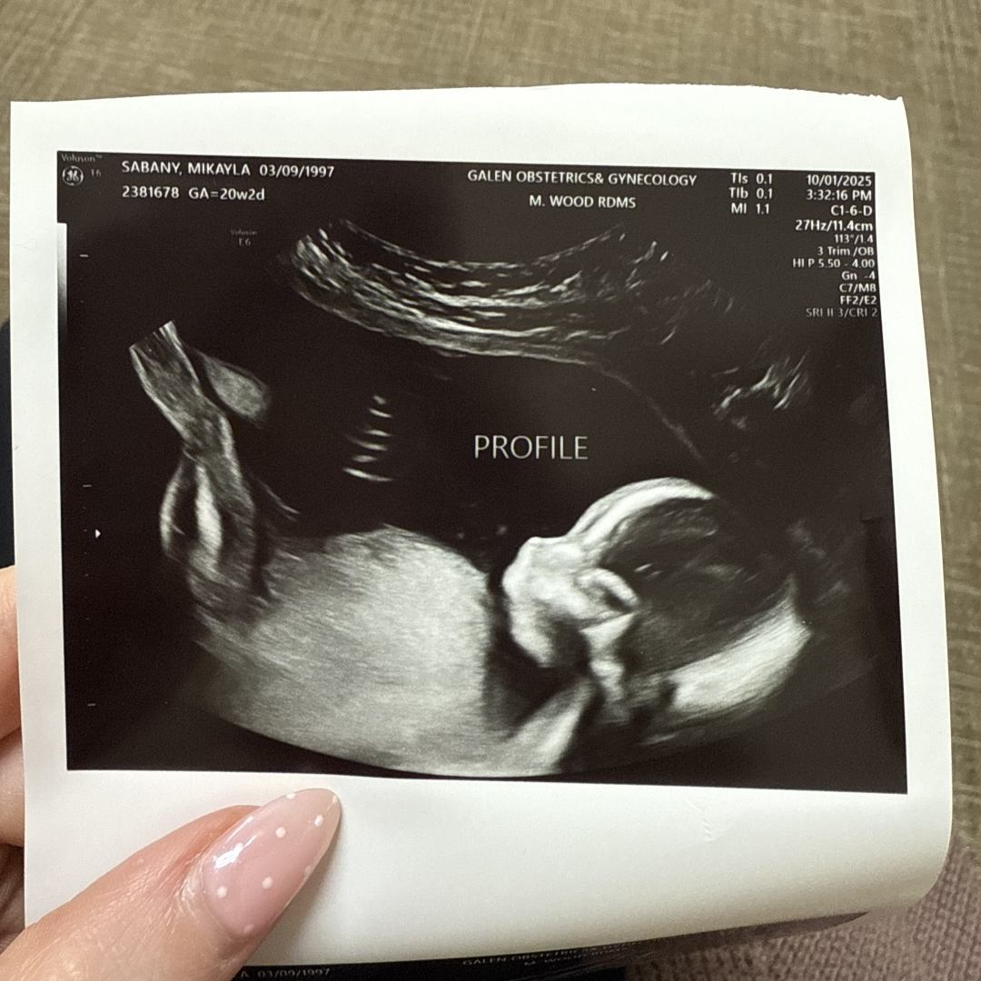 Photo shared by Mikayla for their Babylist baby registry.