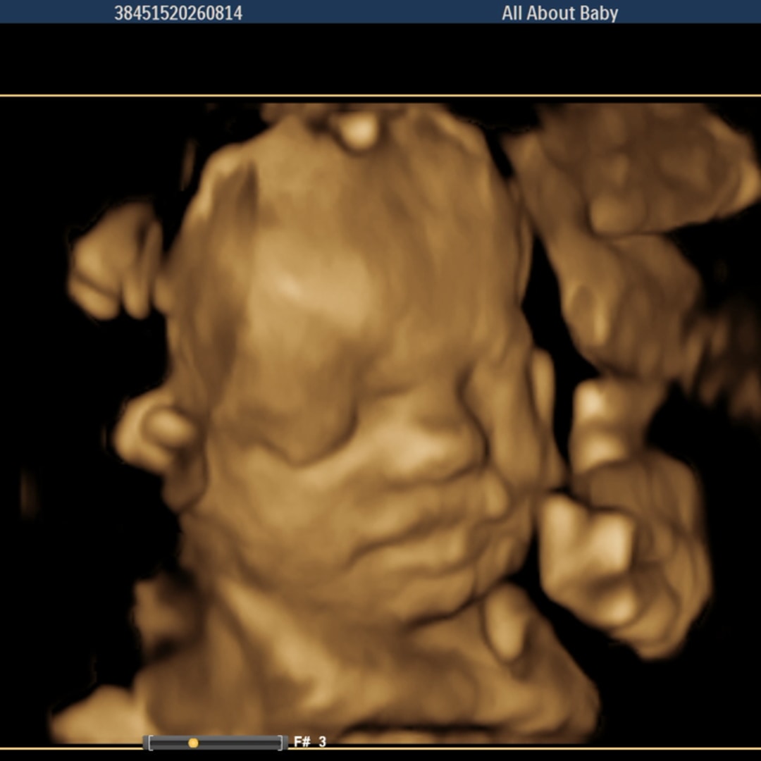 Photo shared by Emilee for their Babylist baby registry.