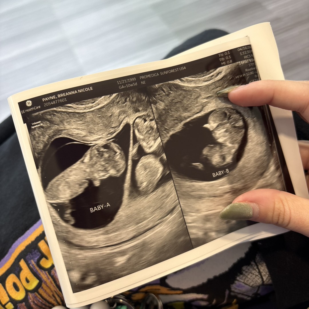 Photo shared by Breanna for their Babylist baby registry.