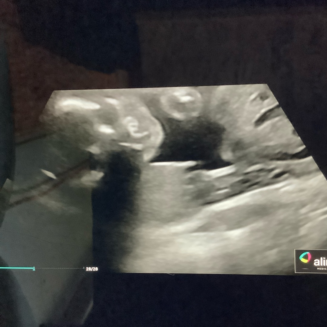 Photo shared by Zachary for their Babylist baby registry.