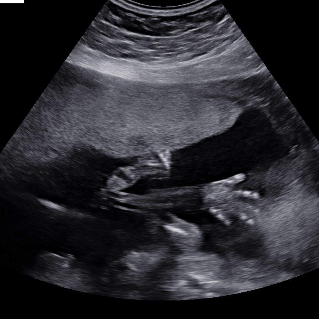 Photo shared by Sarah for their Babylist baby registry.