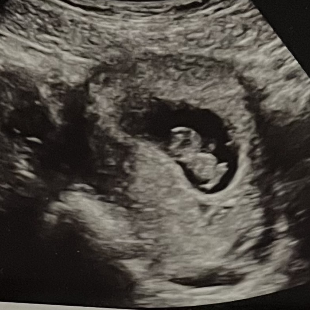 Photo shared by Michelle for their Babylist baby registry.