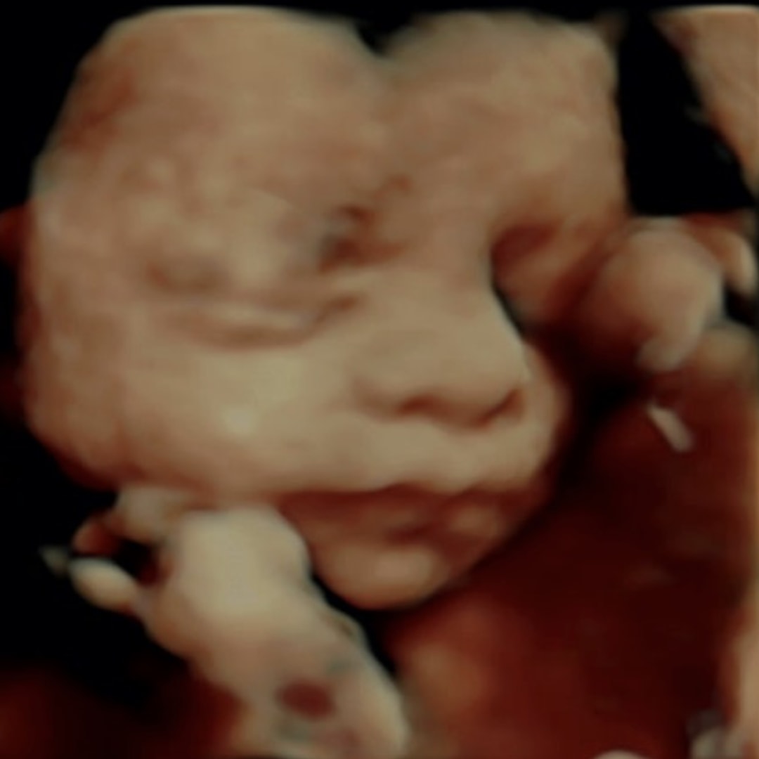 Photo shared by Alison for their Babylist baby registry.