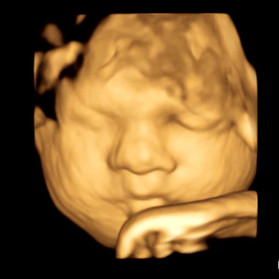 Photo shared by Ashlie and Matthew for their Babylist baby registry.