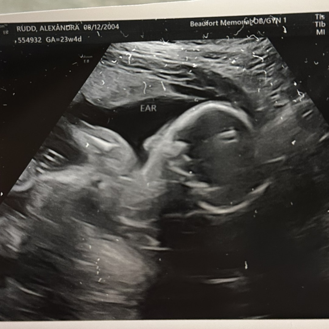 Photo shared by Alexandra for their Babylist baby registry.