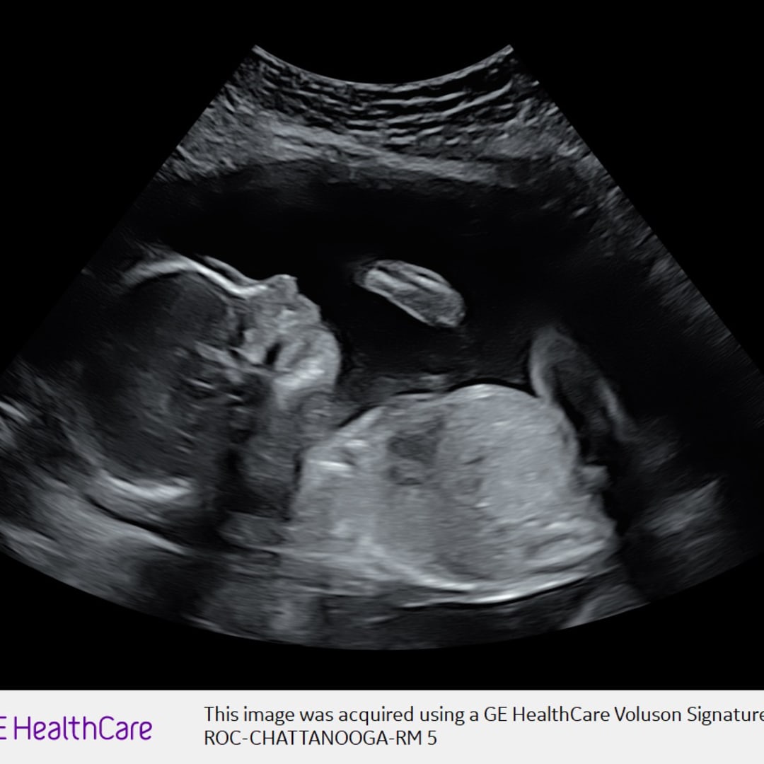 Photo shared by Neely for their Babylist baby registry.
