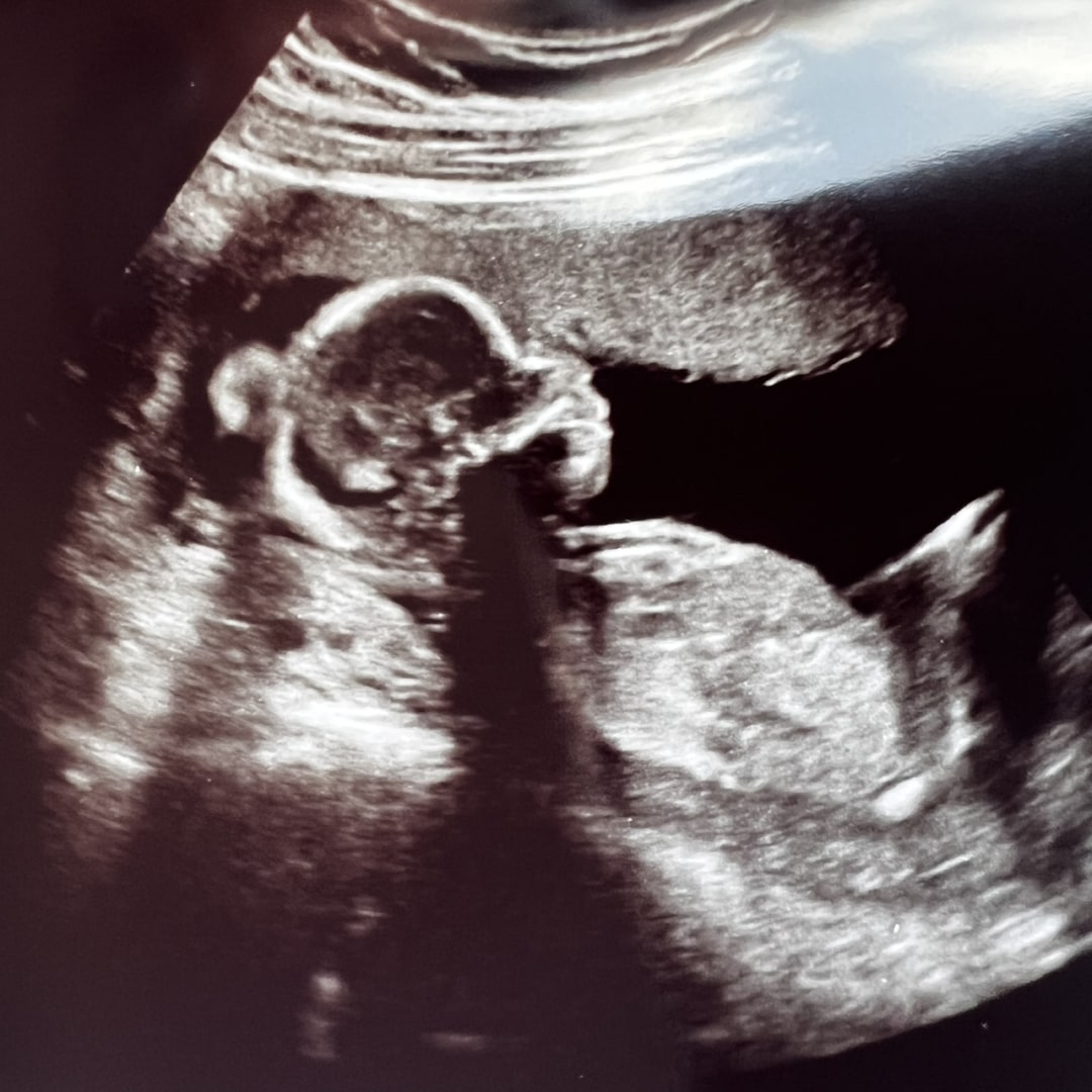 Photo shared by Alexis for their Babylist baby registry.