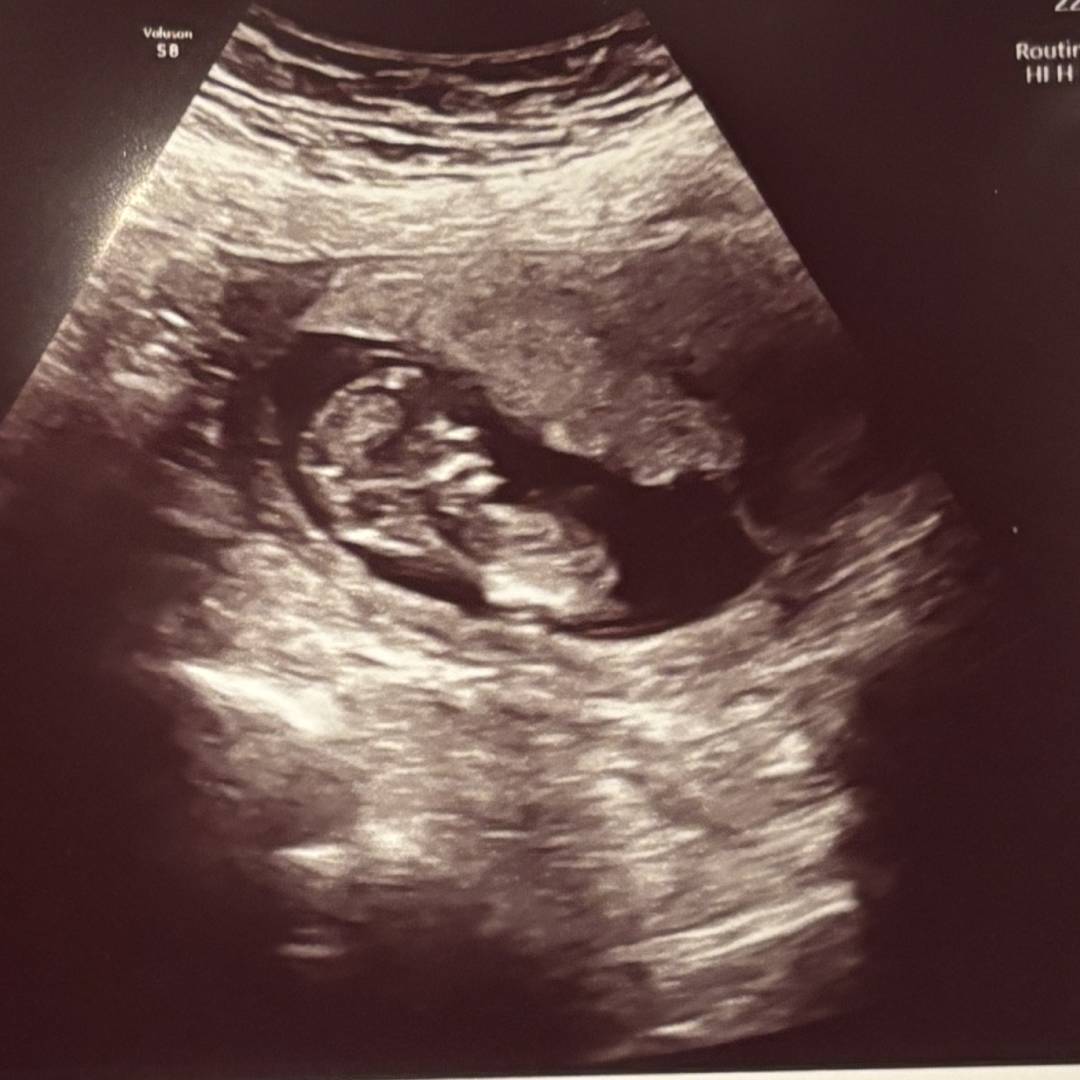 Photo shared by Madison for their Babylist baby registry.