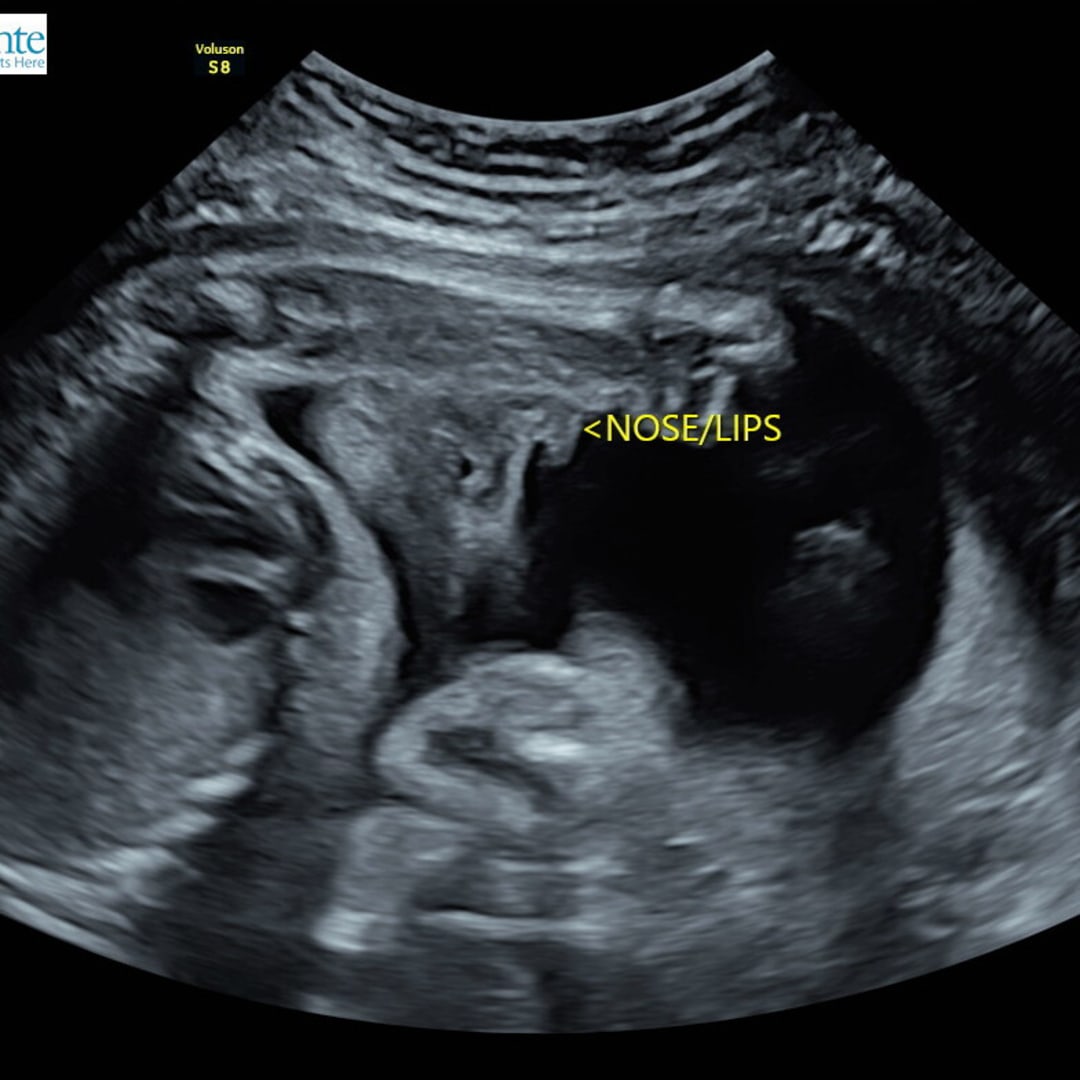 Photo shared by Celeste for their Babylist baby registry.