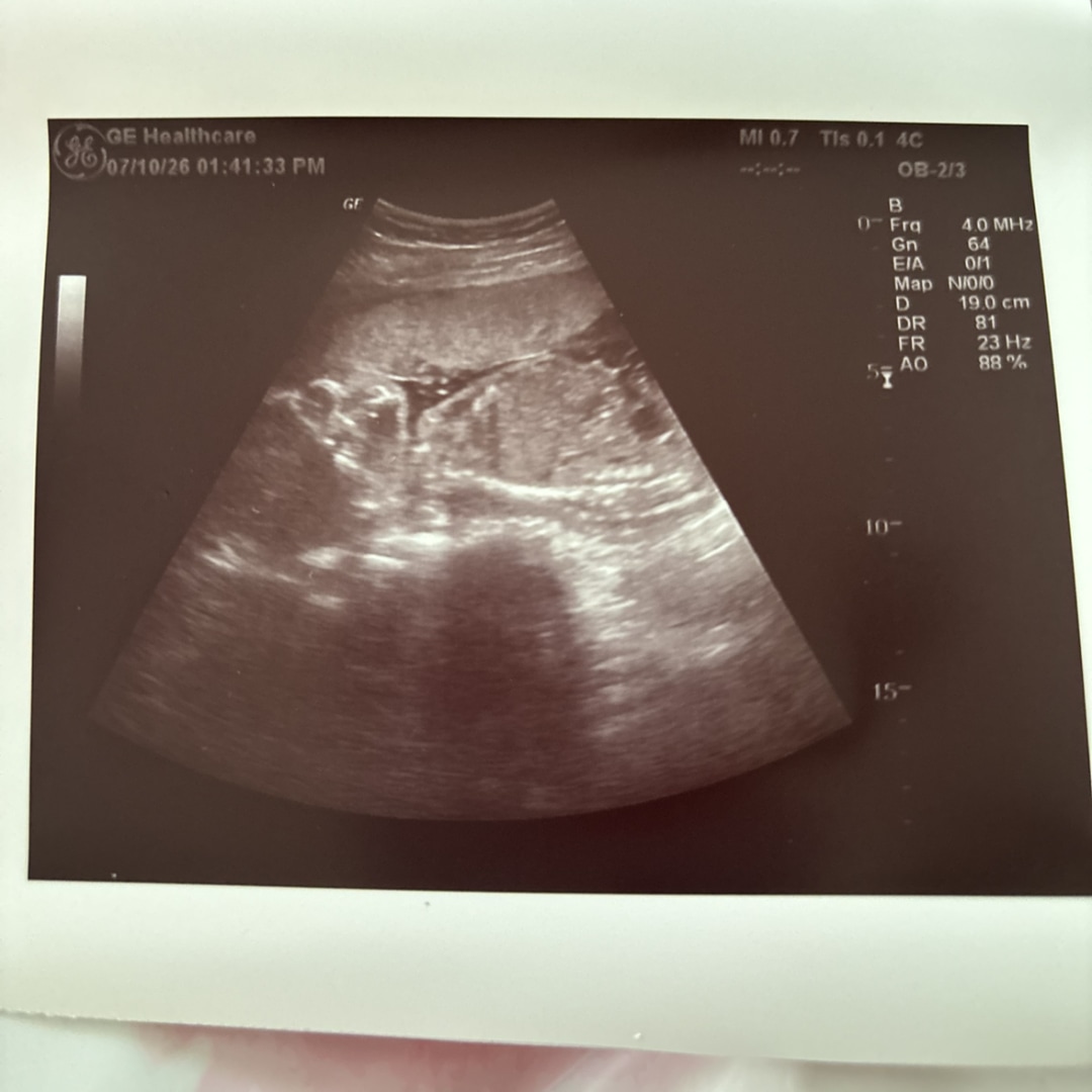 Photo shared by Ella for their Babylist baby registry.