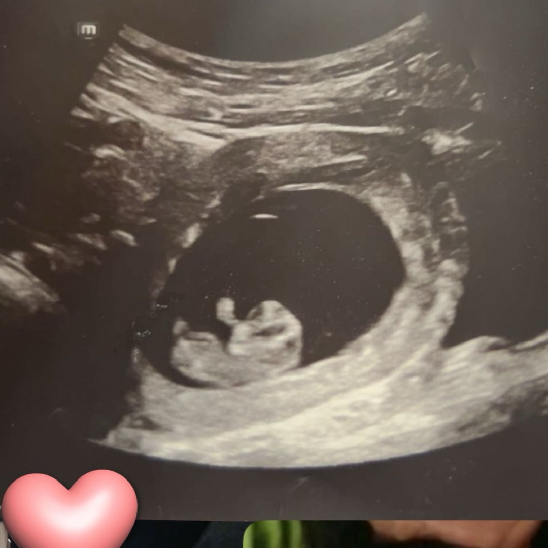 Photo shared by Teresa for their Babylist baby registry.