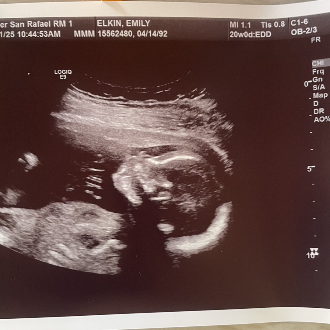 Photo shared by Emily for their Babylist baby registry.