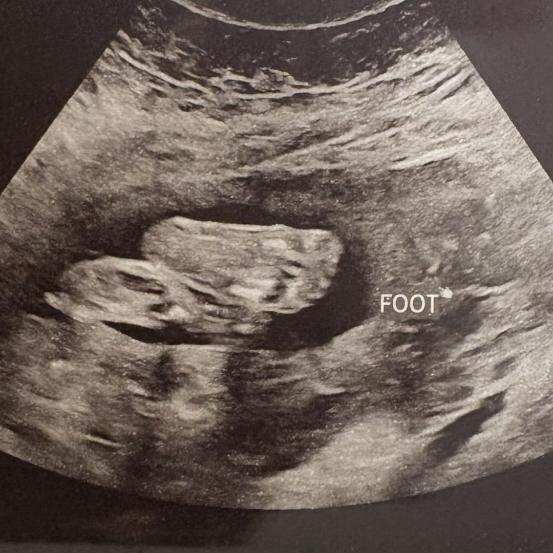 Photo shared by Brittany for their Babylist baby registry.