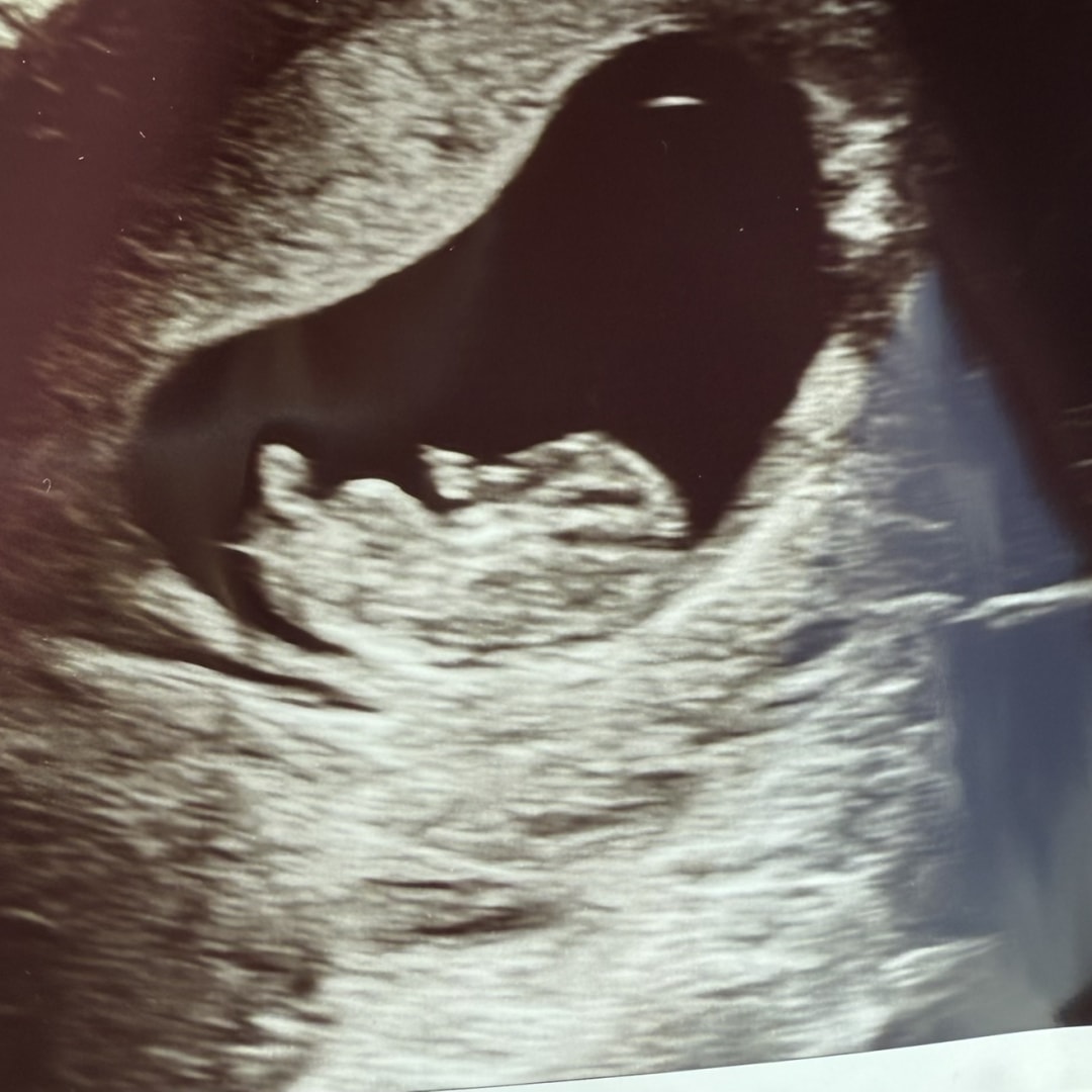 Photo shared by Shelby for their Babylist baby registry.