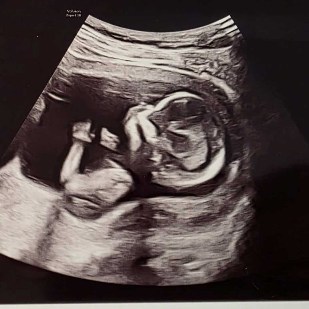 Photo shared by Janae for their Babylist baby registry.