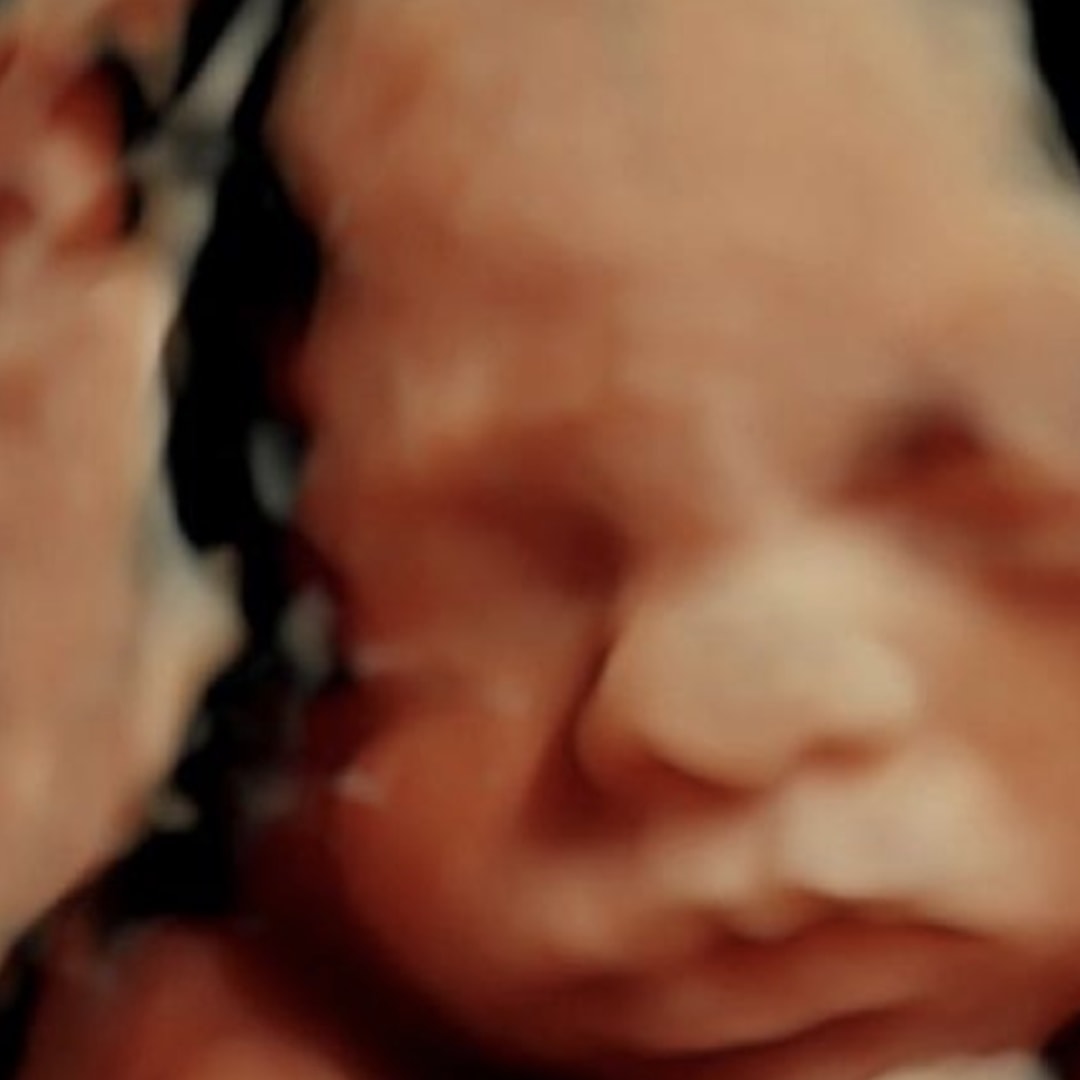 Photo shared by Jatoya for their Babylist baby registry.